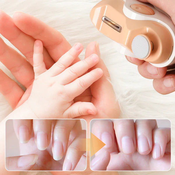 Cortaúñas Limador Eléctrico - NailCutter™